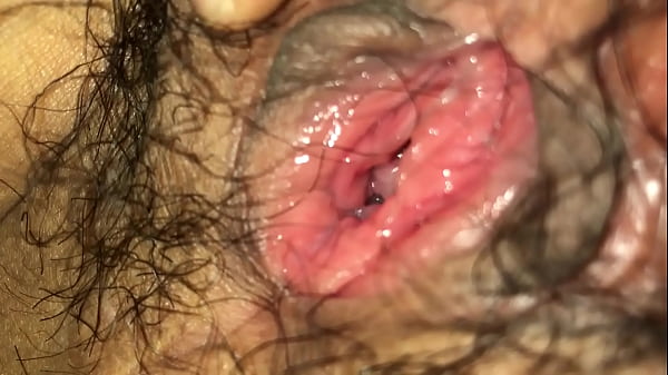 Bím của em sao nó đỏ tròn thế
